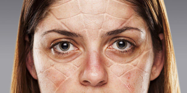 Woman with pressure marks on her face